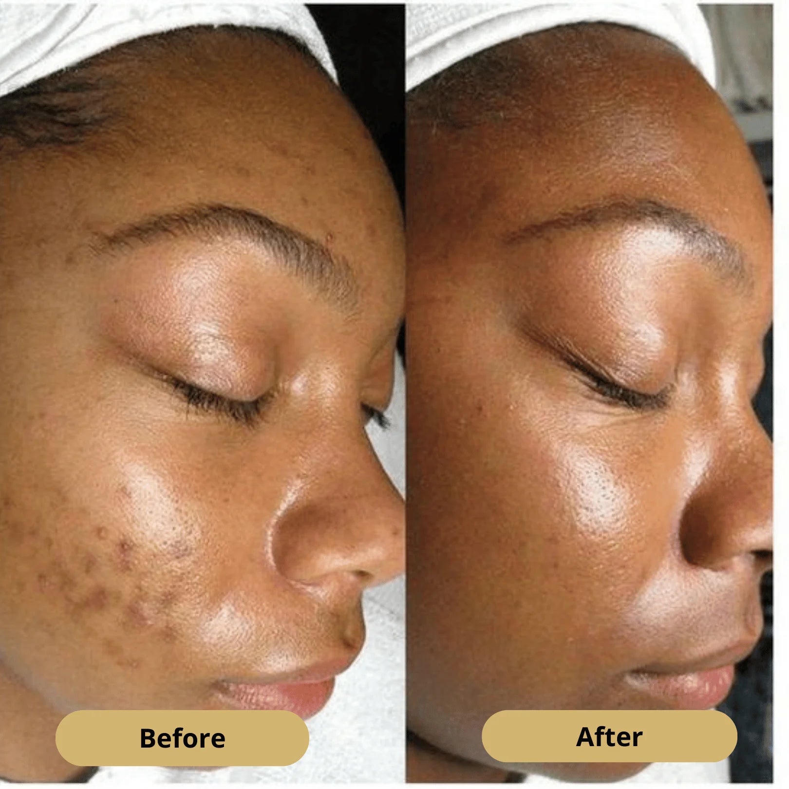 Kojic Acid & Turmeric Soap